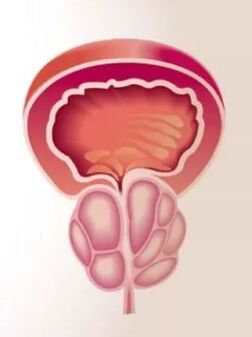 Vnetje prostate